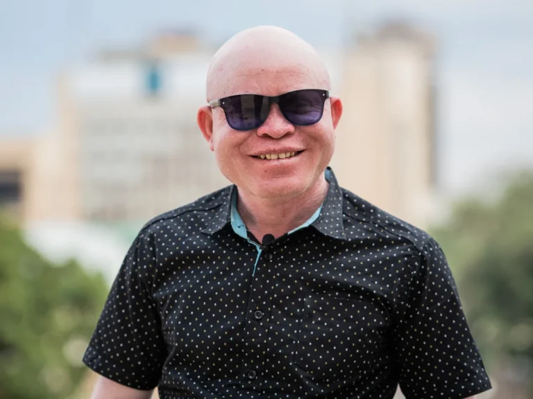 AFZ BEMOANS ATTACKS ON PEOPLE WITH ALBINISM