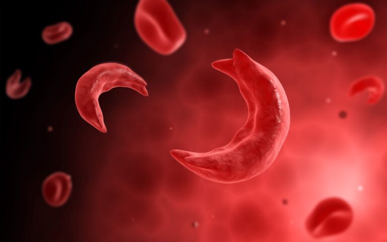 LNF CALLS FOR MORE COMMUNITY AWARENESS ON SICKEL CELL ANAEMIA